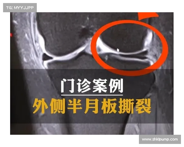 半月板撕裂背后,马祖拉回顾老鹰逆转:输球后痛苦加剧,自己也没能挺住 半月板撕裂背后,马祖拉回顾老鹰逆转:输球后痛苦加剧,自己也没能挺住